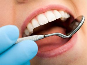 احتمال پوسیدگی مجدد دندان