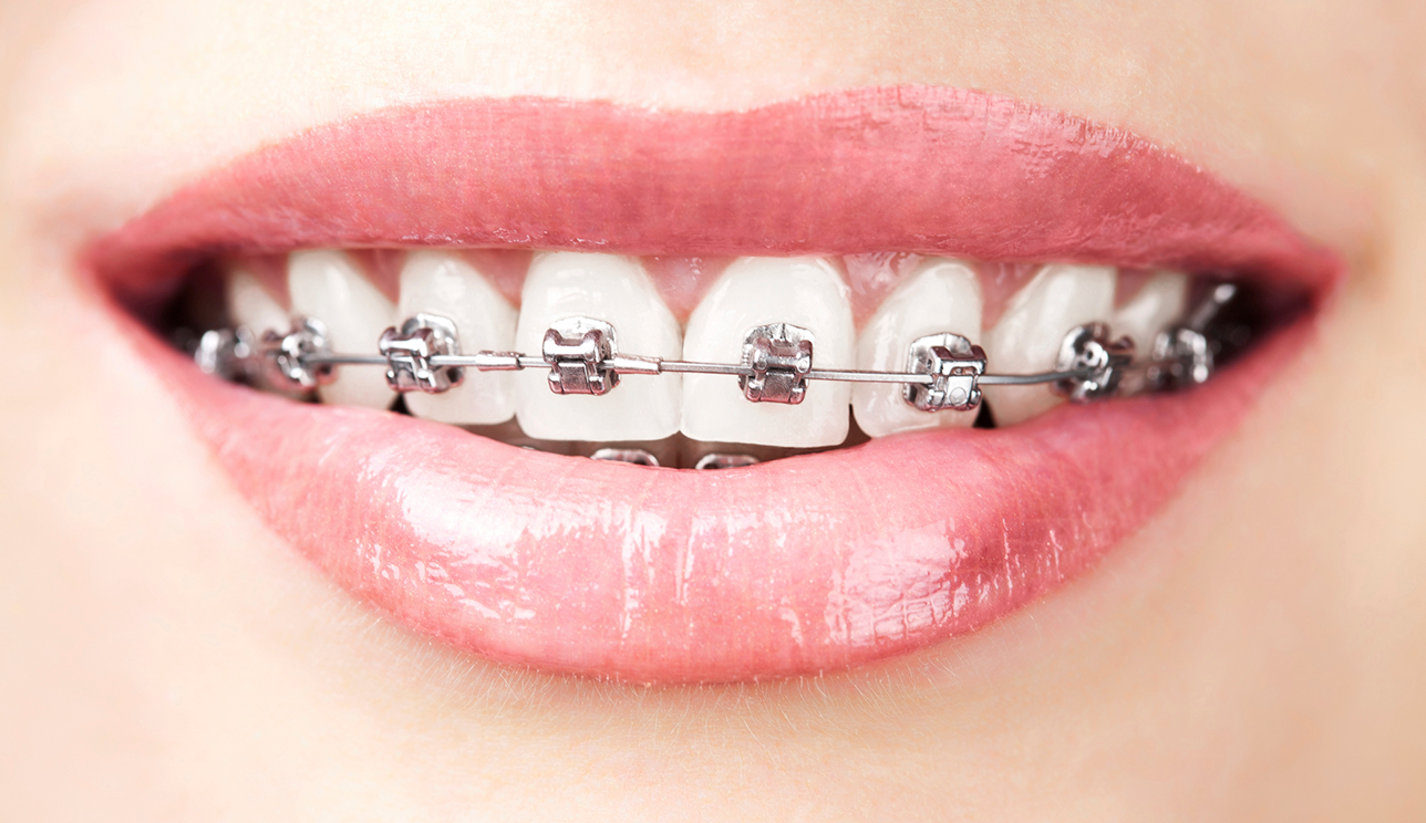 کلینیک دندانپزشکی آرکا - ارتودنسی دامون