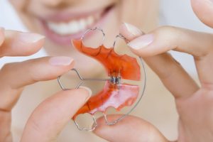 کلینیک دندانپزشکی آرکا - ارتودنسی متحرک