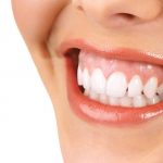 کلینیک دندانپزشکی آرکا - پایین بودن لثه