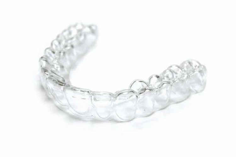 کلینیک دندانپزشکی آرکا - پلاک های شفاف اینویزالاین ارتودنسی