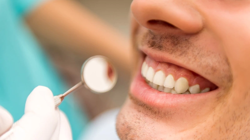 عفونت دندان چیست؟