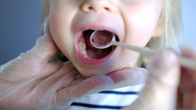 علائم اصلی نشان دهنده ی بروز عفونت دندان