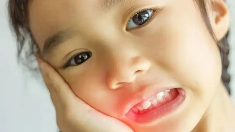 آبسه دندان کودکان