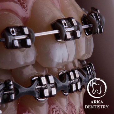 کلینیک دندانپزشکی آرکا-ارتودنسی۳