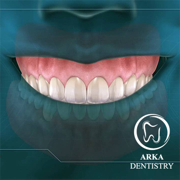 کلینیک دندانپزشکی آرکا-جراحی لثه۱