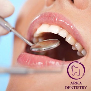 کلینیک دندانپزشکی آرکا-خدمات پیشگیری و مراقبت