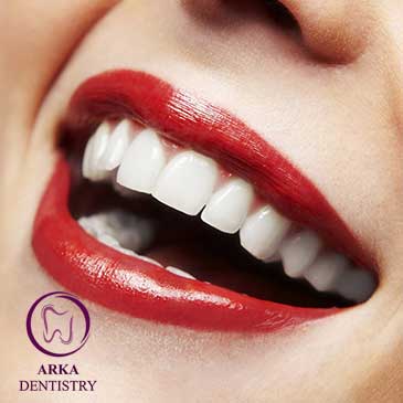 کلینیک دندانپزشکی آرکا - دندانپزشکی زیبایی ۲
