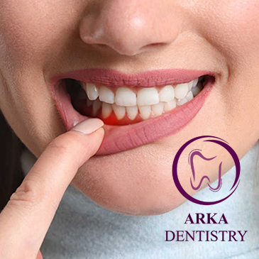 کلینیک دندانپزشکی آرکا - پریو۱