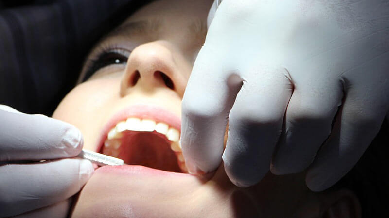 مزایای آمالگام دندانی - آمالگام چیست