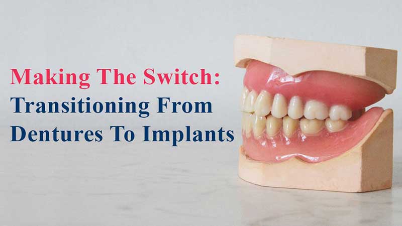 ایجاد تغییرات: انتقال از دندان مصنوعی به ایمپلنت
