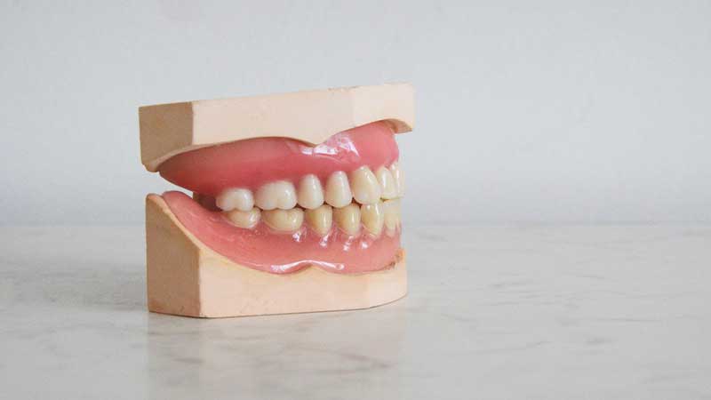 چرا تغییرات ایجاد می‌شود - انتقال از دندان مصنوعی به ایمپلنت