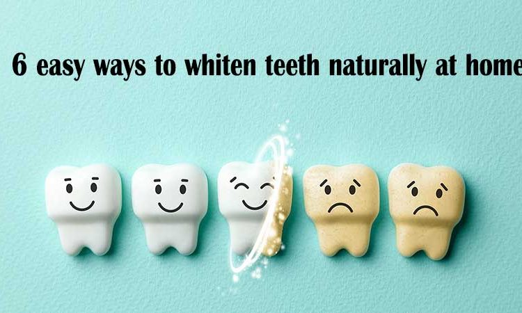 ۶ روش آسان برای سفید کردن دندان ها به صورت طبیعی در خانه