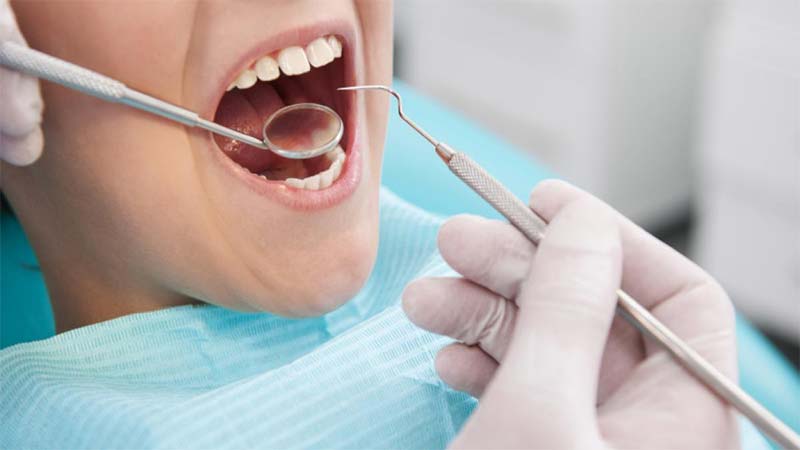 اصلاح و فرم دهی ونیر کامپوزیت - مراحل کامپوزیت دندان