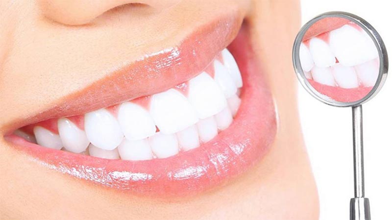 هزینه لمینت دندان - عوارض لمینت دندان