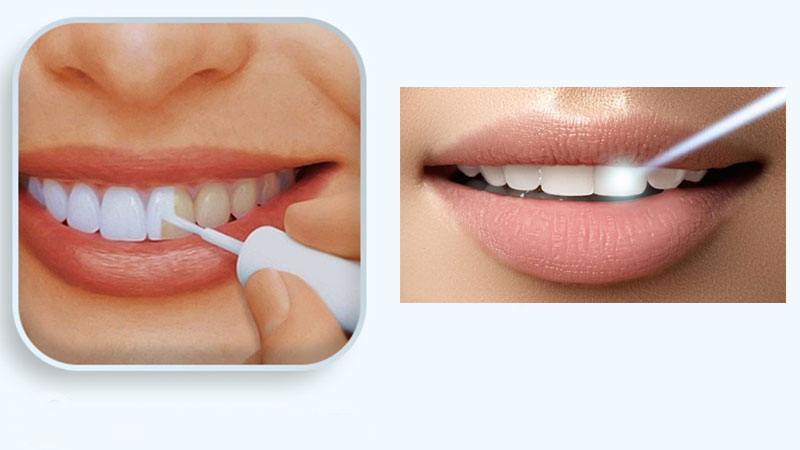 آیا لاک سفید کننده دندان بی‌خطر است؟