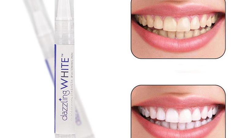 دستورالعمل مناسب برای استفاده از لاک سفید کننده دندان