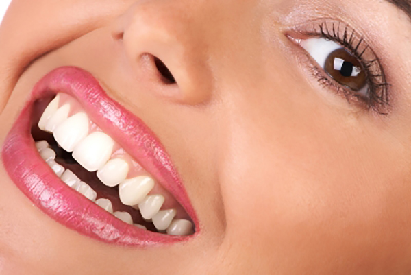 کلینیک-دندانپزشکی-آرکا-گالری-دندانپزشکی-زیبایی