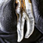 کلینیک-دندانپزشکی-آرکا-گالری-عصب-کشی-دندان