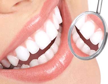 ۵ روش مفید دندانپزشکی زیبایی که باید درباره آن‌ها بدانید