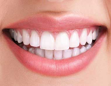 دندانپزشکی زیبایی چیست؟ هزینه‌ها و انواع