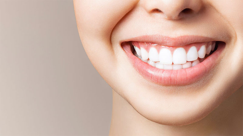 عوارض روکش های لومینیرز - لومینیرز دندان