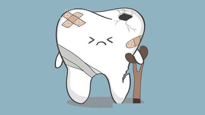 عوامل ترومای دندان