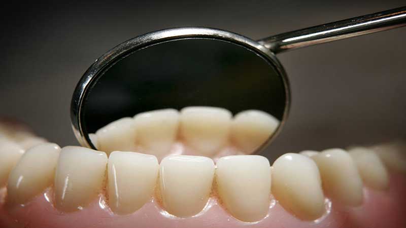 آسیب‌های ناخواسته‌ای که توسط خود افراد به دندان وارد می‌شود