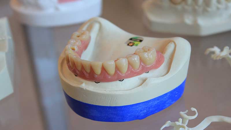 وقتی دندان دائمی از فک بیرون بیفتد چه باید کرد؟ - تروما چیست