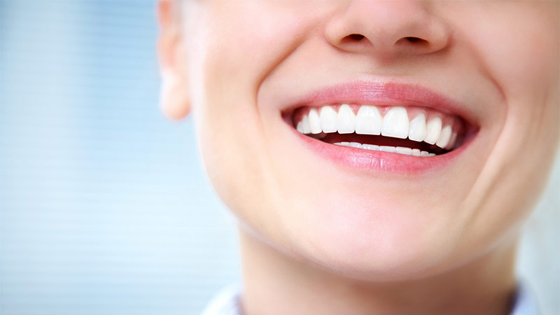 آیا قصد دارید دندان‌های خود را سفید کنید؟ - مزایای بلیچینگ دندان