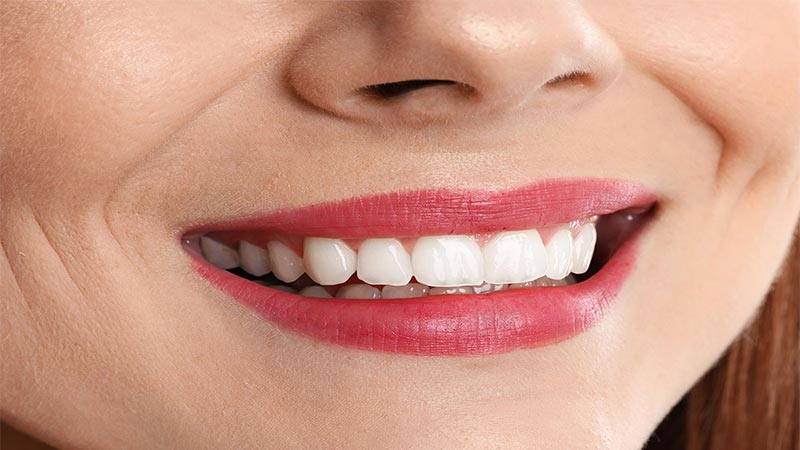 بهترین اقدامات برای ماندگاری مزایای بلیچینگ - مزایای بلیچینگ دندان