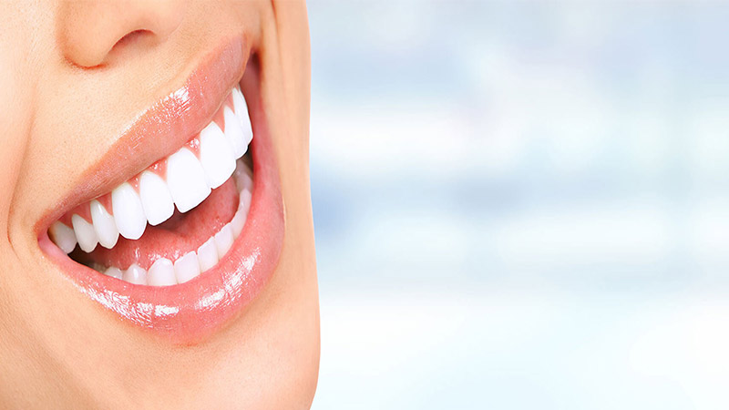 فواید و مزایای اینله و انله کردن دندان - اینله و انله دندان چیست