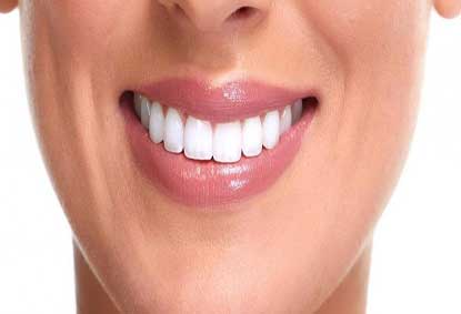 مراقبت‌های بعد از بلیچینگ دندان