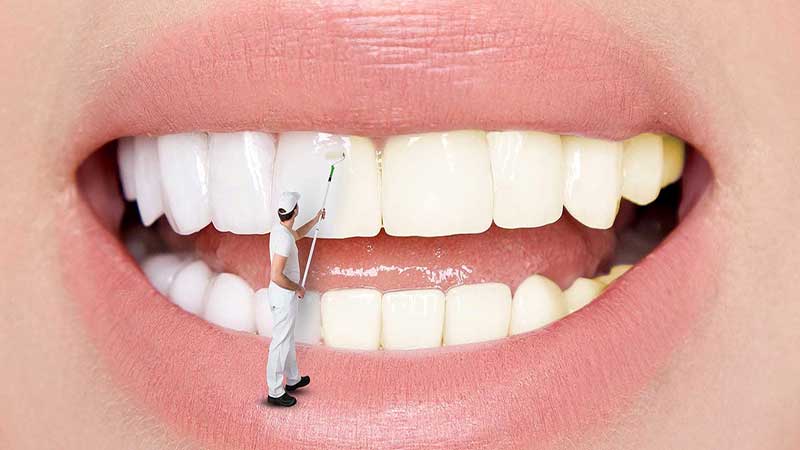مهم‌ترین علت تغییر رنگ دندان‌ها