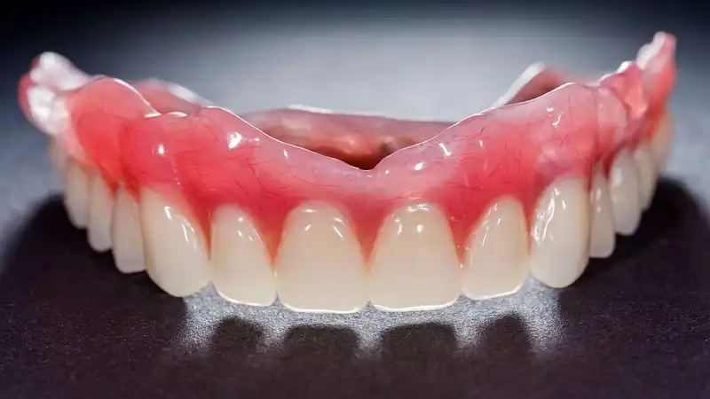 پروتز ثابت دندان چیست؟