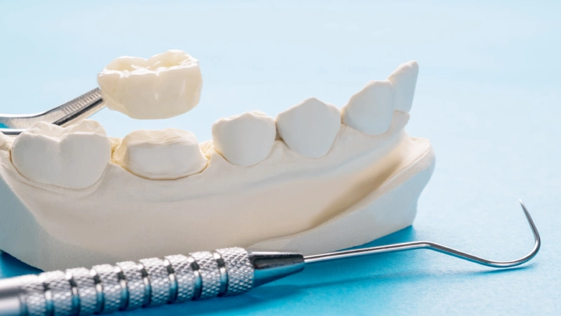 تفاوت بازسازی اساسی دندان با ترمیم حفره‌های سطحی و متوسط دندانی چیست؟