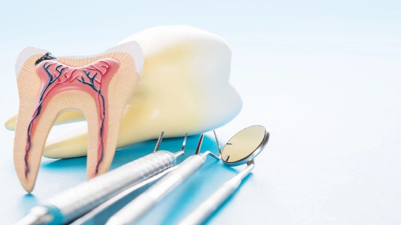 بیمه دندانپزشکی برای عصب کشی