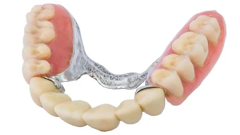 روش آماده سازی پروتز دندانی به چه صورت است؟