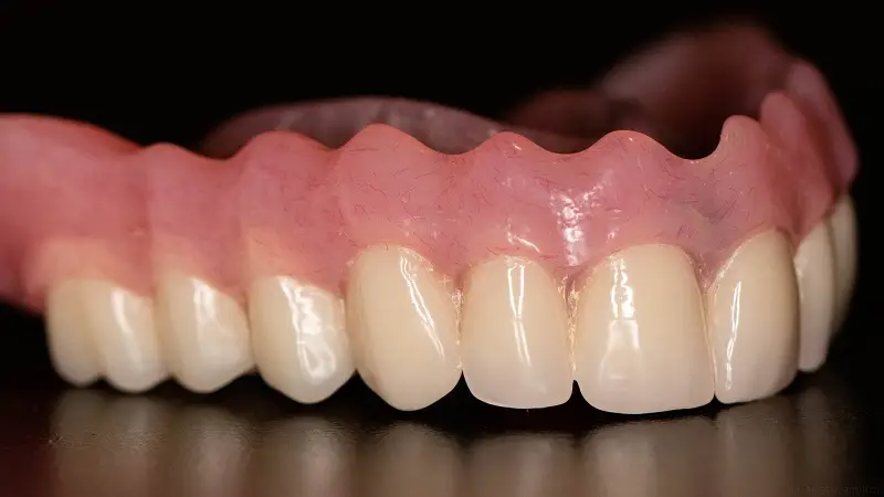 پروتز متحرک دندان چیست؟