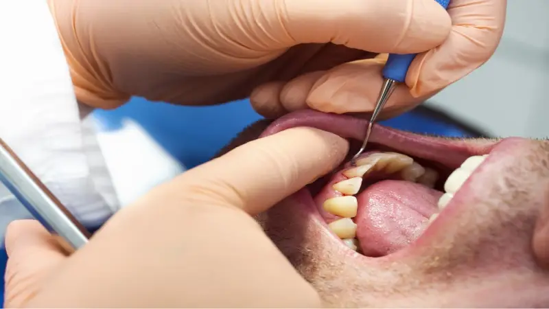 مناسب ترین زمان برای مراجعه به دندانپزشک